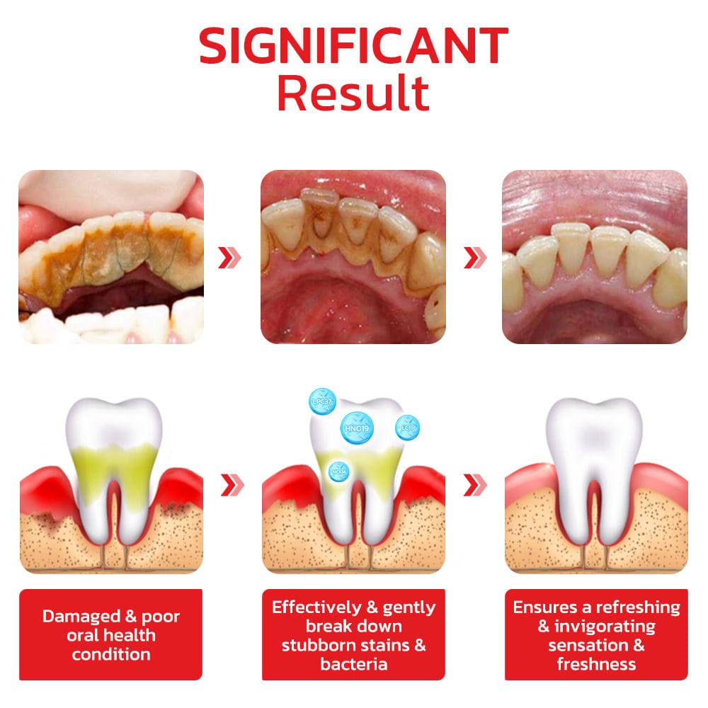 SP-4 Probiotic Teeth Whitening Toothpaste