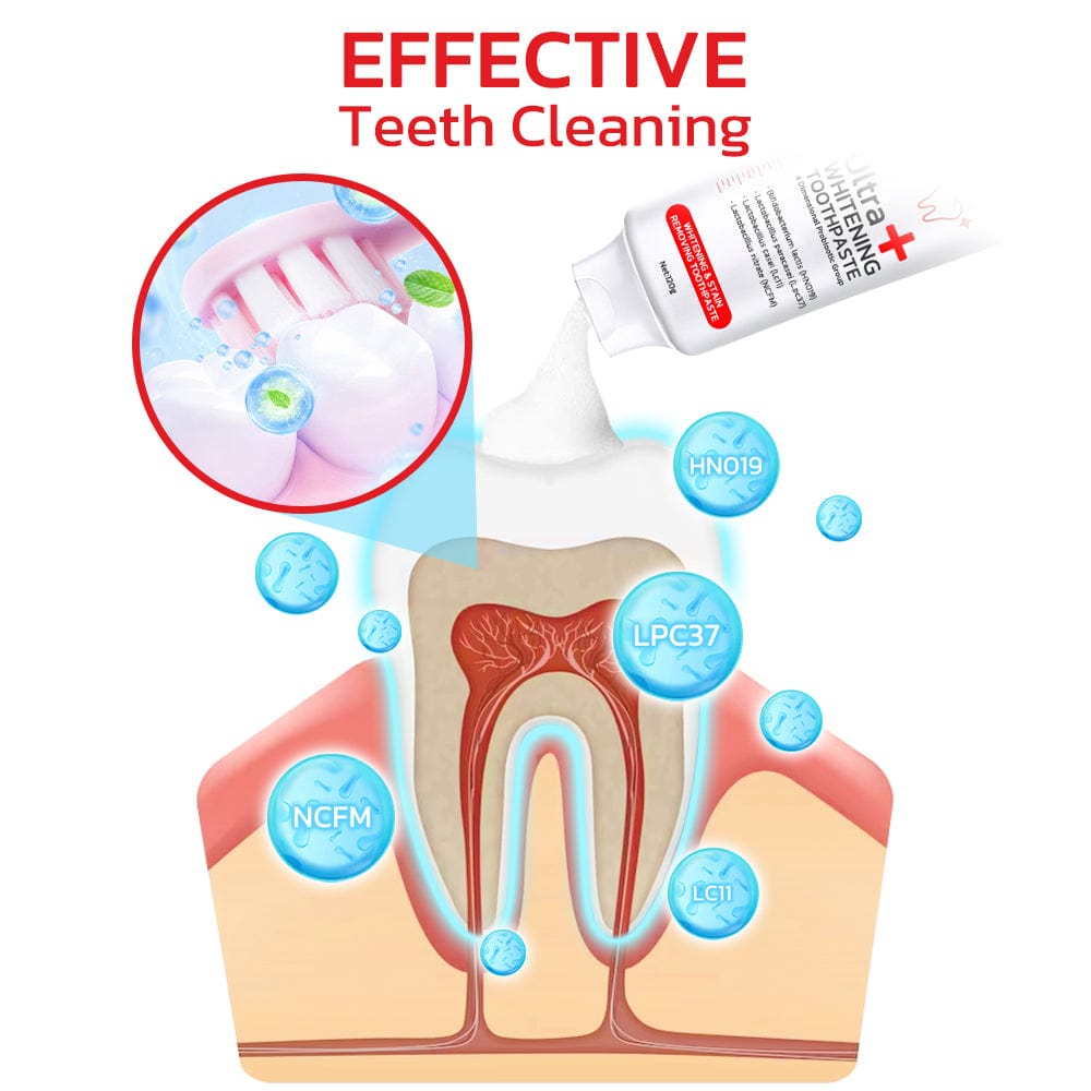 SP-4 Probiotic Teeth Whitening Toothpaste