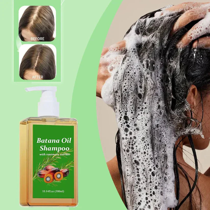 Batana Oil Shampoo for Hair Growth (Pack of 2)